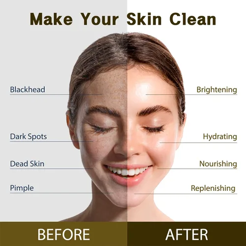 Vista 3 de Purederm Trío de mascarillas faciales veganas (12 paquetes) - Mascarillas faciales para el cuidado de la piel seca, deshidratada y opaca