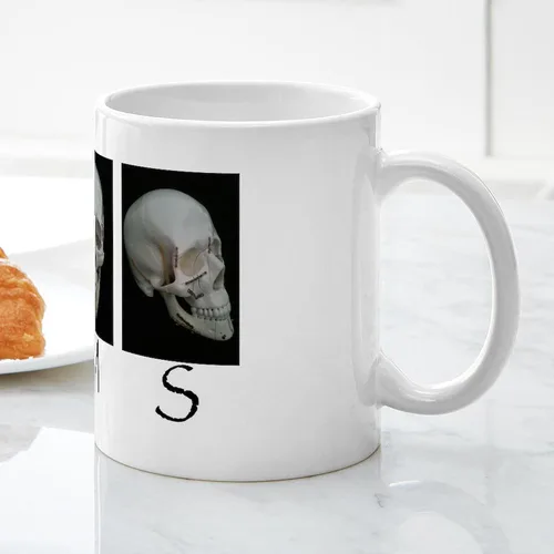 Vista 5 de CafePress OMS - Taza quirúrgica con diseño de calavera de 11 oz (11.0 fl oz)