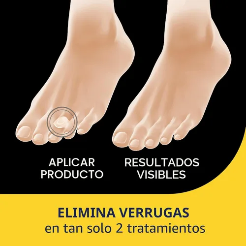 Vista 3 de Dr. Scholl's Eliminadores de verrugas en un solo paso, 14 unidades/ Elimina las verrugas en tan solo 2 tratamientos, máxima resistencia, fácil