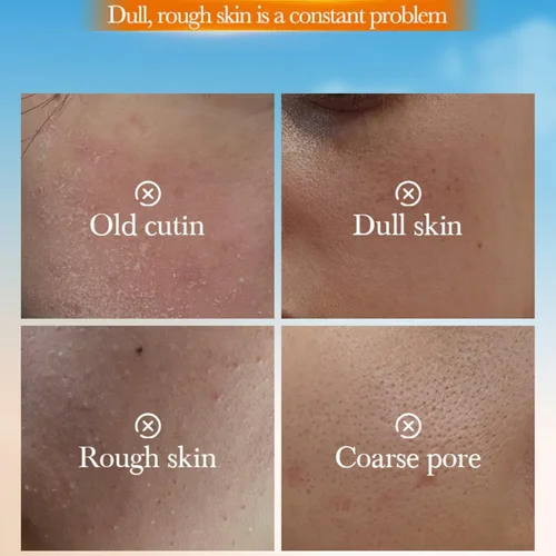Vista 3 de Gel exfoliante naranja, gel pelador de vitamina C para cara y cuerpo, exfoliante facial suave, exfoliante hidratante y de limpieza profunda, suaviza