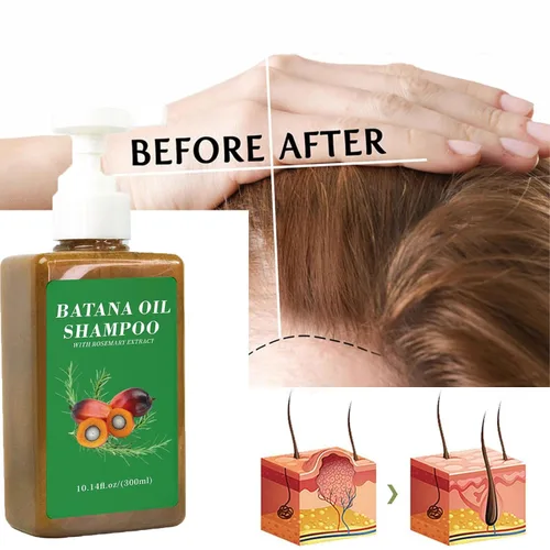 Vista 2 de Champú de aceite de Batana,Aceite de batana para el crecimiento del cabello,Champú DeBatana Para La Caida Del Cabello,Champús contra la pérdida