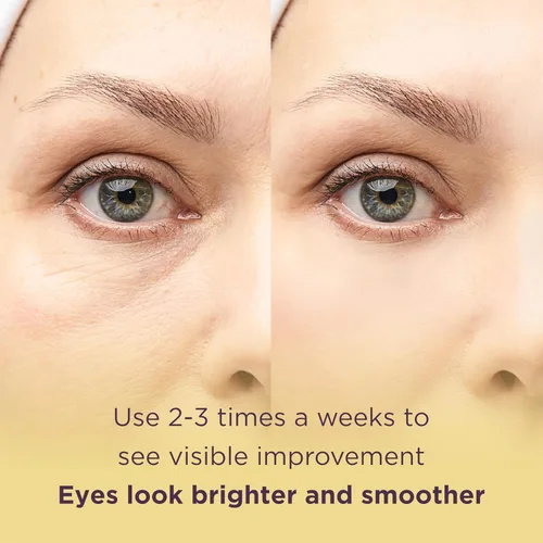 Vista 6 de MATKAS Retinol Renewal Gold - 20 pares, los mejores parches para ojos hinchados y ojeras, parches de colágeno debajo de los ojos para mujeres