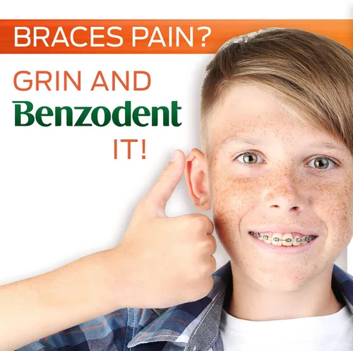 Vista 6 de Benzodent Crema para aliviar el dolor dental y oral de máxima fuerza para dentaduras, llagas bucales y aparatos ortopédicos, anestésico tópico