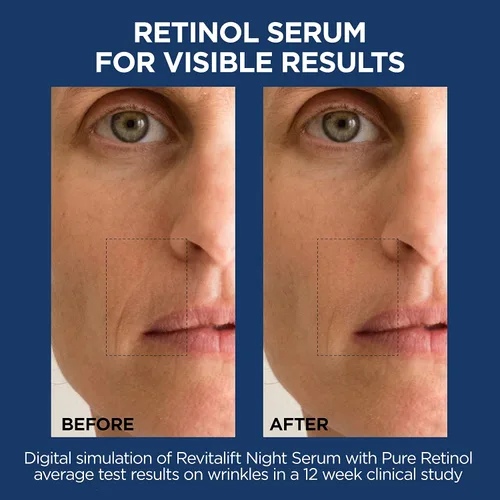 Vista 7 de L'Oreal Paris Revitalift - Suero facial de ácido hialurónico puro 1.5% + suero nocturno de retinol puro al 0.3%, 1 kit
