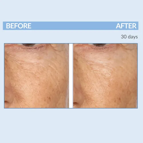 Vista 7 de Serious Skincare Vitamin A Force XR Retinol suero concentrado facial, micro exfoliante y rejuvenecimiento para piel radiante, para líneas, arrugas