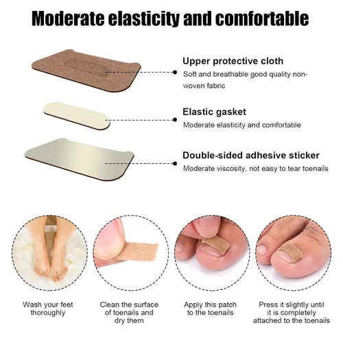 Vista 3 de Corrector de uñas encarnadas, 100 parches correctores transpirables con nudo de lazo y 120 tiras de uñas encarnadas ranuradas, herramienta de cinta