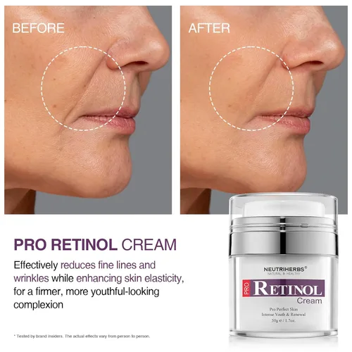 Vista 4 de Neutriherbs Crema de retinol para cara, hidratante facial de noche rica en vitamina A, reduce las líneas finas y suaviza las arrugas, cuidado