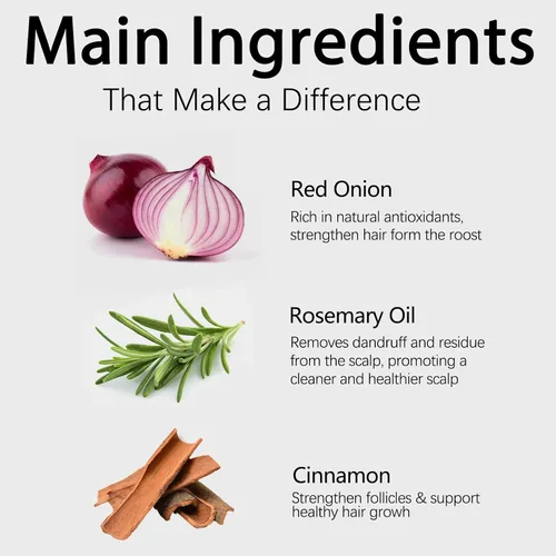 Vista 6 de Champú, champú de cebolla para el crecimiento del cabello, con aceite de romero, cebolla roja, canela, previene eficazmente la pérdida de cabello