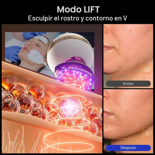 Vista 5 de INIA SPHERA - Dispositivo facial de microcorriente 8 en 1 mejorado