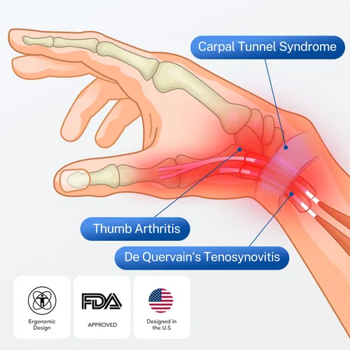 Vista 3 de Soporte para pulgar todo en uno con estabilizador de palma y muñeca: alivio del dolor para túnel carpiano, tenosinovitis de De Quervain, tendinitis