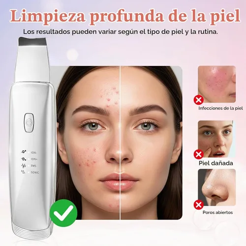 Vista 6 de Herramientas para quitar puntos negros, espátula facial 4 en 1 para Plateado