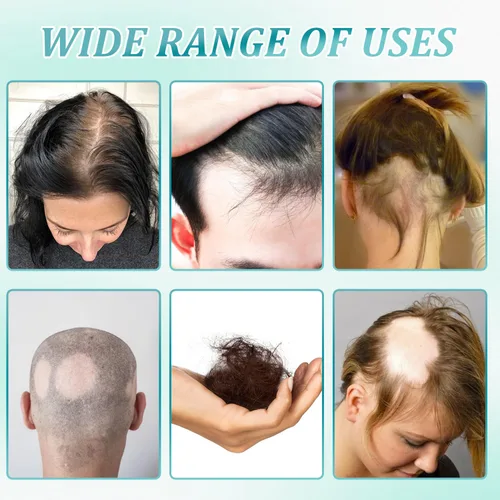Vista 6 de 2 cremas de masaje para el cuero cabelludo al 5% del crecimiento del cabello, anti-pérdida de cabello con biotina de romero para hombres y mujeres