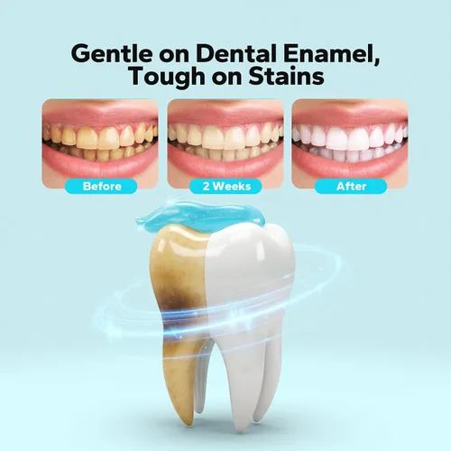 Vista 3 de Pasta dental blanqueadora de niacinamida (paquete de 2), pastas dentales de niacinamida para adultos, pasta de dientes blanca radiante para eliminar