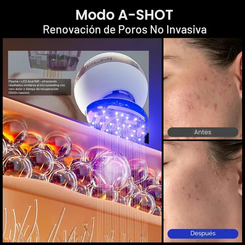 Vista 8 de INIA SPHERA - Dispositivo facial de microcorriente 8 en 1 mejorado