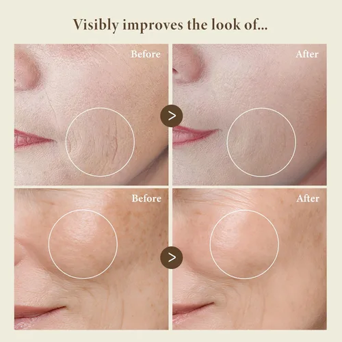 Vista 4 de BIOCHEM Golden Placenta Ultra Essence - Suero facial de placenta con lámina dorada, antienvejecimiento, hidratante, reafirmante, arrugas, líneas