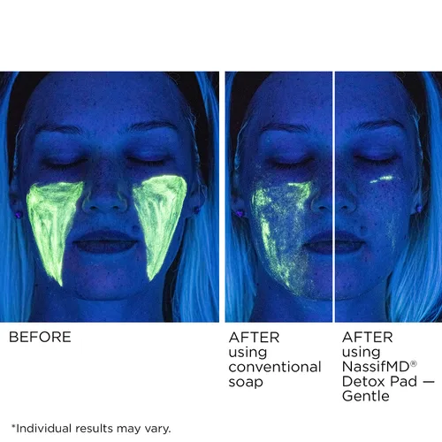 Vista 6 de NassifMD Almohadillas de desintoxicación suaves, complejo de ácido frutal creado por cirujanos para pieles sensibles, ilumina, exfolia y reduce