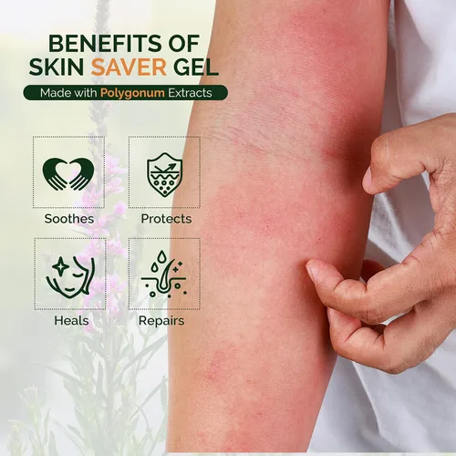 Vista 3 de Moraz Skin Saver - Gel curativo de hierbas para reparación de la piel y cuidado de heridas, hidratante multiusos de primeros auxilios para piel