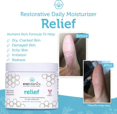 Vista 5 de Crema para la psoriasis y el eczema humectante no grasosa con aloe vera orgánico, miel manuka, aceite de cáñamo y más. 4 oz. El mejor humectante