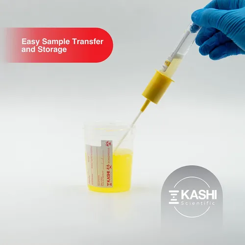 Vista 4 de Kashi Scientific Vaso estéril para muestras con tapa y sellado seguro envuelto individualmente para recolección de orina o semen, taza de orina