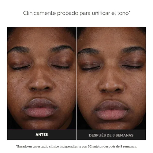 Vista 3 de Paula's Choice Suero con 25% de vitamina C con glutatión y antioxidantes, el suero facial mejora la decoloración, el tono desigual y reafirma, todo