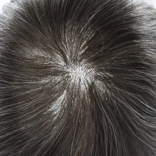 Vista 5 de Toupee para hombres, pieza de cabello humano real, sistema de reemplazo de cabello de piel ultrafina, piezas de cabello tipo tupé, prótesis
