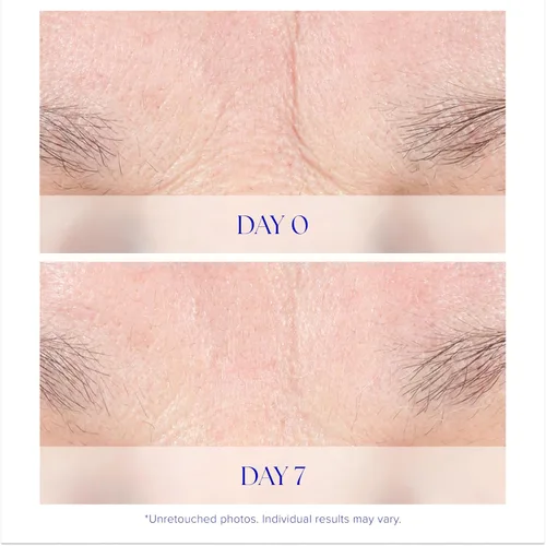 Vista 4 de iS CLINICAL Crema intensiva juvenil. Crema facial antienvejecimiento y reafirmante. Reduce la apariencia de finas finas y arrugas.