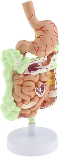 Vista 2 de KESOTO Modelo de Patología Gastrointestinal Humana Modelo Coronal Gástrico del Tracto Digestivo para Estudiantes Escolares Aprendizaje