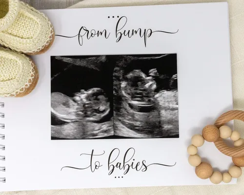 Vista 4 de Personalized Twin Pregnancy Journal (8 Center Designs) - Hardcover Pregnancy Memory Book Customized with Babies’ Names, Nicknames or Phrase