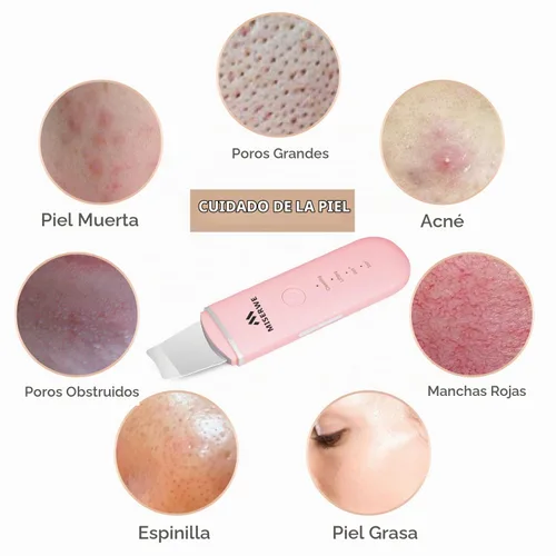 Vista 4 de Espátula facial para la piel, limpiador de poros con 4 modos (Rosa)