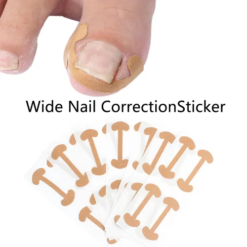 Vista 4 de Juego de corrector de uñas encarnadas con tiras de corrección,Kit de herramientas profesional de uñas encarnadas,Parche corrector de uñas