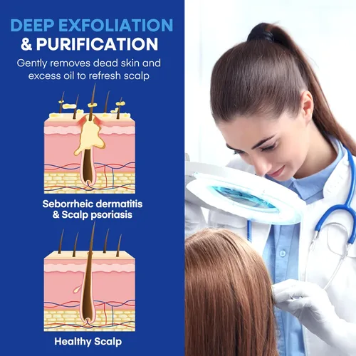 Vista 5 de Champú medicado para la dermatitis seborreica del cuero cabelludo y la psoriasis: Fórmula a base de plantas alivia la picazón, reduce las escamas