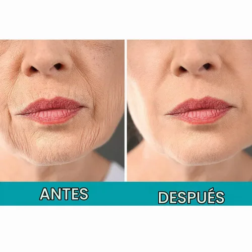 Vista 4 de Dermactin Crema reafirmante para la piel de crepé, 2.5 onzas (paquete de 2)