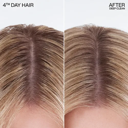 Vista 3 de Redken Champú seco de limpieza profunda para todo tipo de cabello, para cabello oscuro o claro, refresca y absorbe instantáneamente el aceite entre