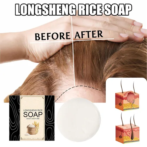 Vista 2 de Gegong Barra de champú, extracto de aloe vera de agua de arroz, ingredientes naturales, tratamiento de pérdida de cabello, control de aceite