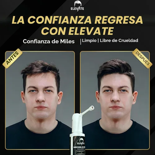 Vista 5 de Elevate Tratamiento de crecimiento del cabello 5% Minoxidil Spray para hombres – Fórmula clínicamente probada de rápida absorción para pérdida