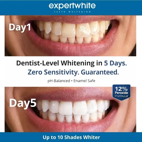 Vista 6 de Flexfit™ Bandejas blanqueadoras de dientes precargadas - Blanqueador dental profesional con peróxido de hidrógeno al 12%, tecnología Dryfit™ lista