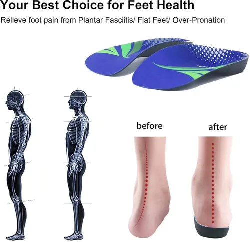 Vista 5 de RooRuns FitFeet - Plantillas ortopédicas de 3/4 de longitud, plantillas de pie de soporte de arco alto para sobrepronación, fascitis plantar, pies