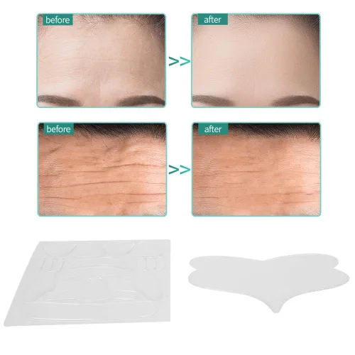Vista 5 de 17pcs Anti-Envejecimiento Anti-Arrugas Parches Cara Para Rejuvenecer La Piel Elasticidad Y La Piel Levantamiento De La Piel, Almohadilla De Silicona