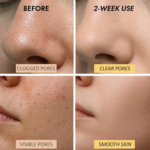 Vista 6 de Máscara facial de arcilla calentadora para limpieza profunda de poros – Máscara de barro autocalentable para cara, tratamiento purificador