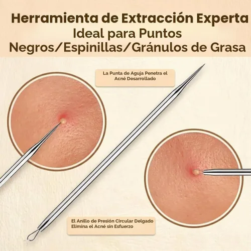 Vista 3 de 2 piezas de herramienta extractora de espinillas de acero inoxidable quirúrgico 410 Extractor de comedones, removedor de espinillas, removedor