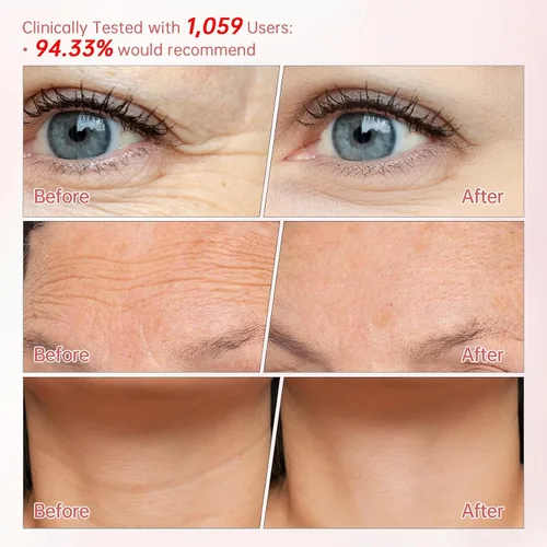 Vista 3 de Peunitory Bálsamo para ojos, crema para debajo de los ojos, tratamiento reafirmante antiarrugas, abrillantador de círculos oscuros, hidratante