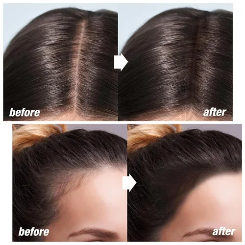 Vista 2 de Boobeen Barra de sombra de línea de cabello, corrector de raíces de cabello y polvo de retoque con esponja, cobertura instantánea para cabello gris
