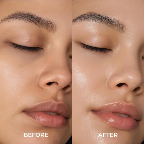 Vista 6 de Parches de ojos de oro de 24 quilates para ojos hinchados y ojeras, cuidado de la piel antienvejecimiento de lujo – Parches antiarrugas de colágeno