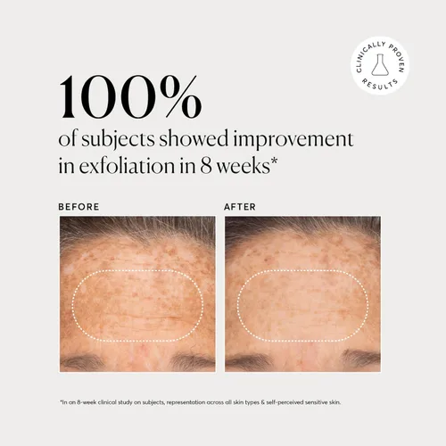 Vista 5 de Naturium BHA Exfoliante Líquido 2%, Tratamiento Exfoliante de Poros Leave-on para Rostro y Cuidado de la Piel, con Ácido Salicílico y Ácidos