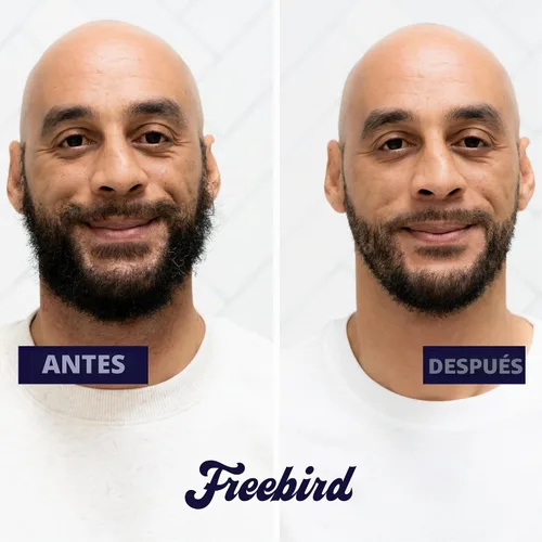 Vista 4 de Freebird BeardSeries - Recortadora de barba ultra afilada con esfera de precisión, cuchillas de acero inoxidable, 40 ajustes de longitud