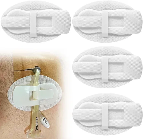 Vista 8 de Dispositivo de Estabilización de Catéter, Soportes para Tubos de Alimentación, Parche de Diálisis PD para Tubo PEG, Tubo J, Tubo G, Accesorios