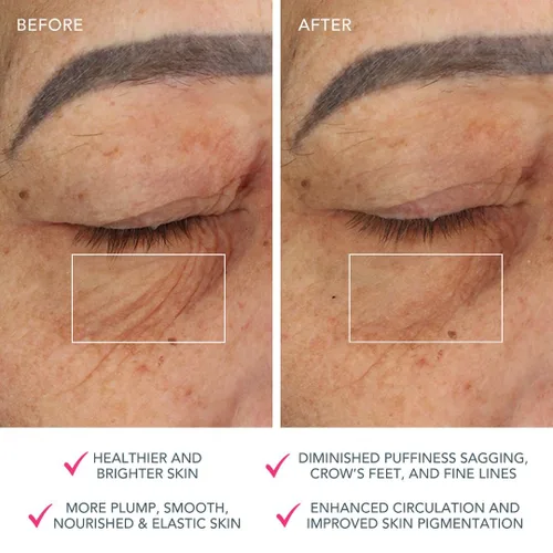 Vista 5 de FOREO Bear Dispositivo Facial de Microcorriente - Herramienta de Esculpido Facial - Lifting Facial Instantáneo - Reafirma y Contornea - No Invasivo