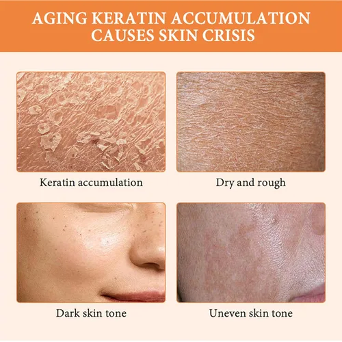 Vista 3 de Exfoliante de gel exfoliante naranja, gel exfoliante facial hidratante de limpieza profunda, gel exfoliante para el cuidado de la piel para cara