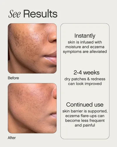 Vista 3 de Topicals Crema hidratante para piel seca, sensible y propensa al eczema, hidratante instantáneo calmante y alivio del eccema para rostro y cuerpo