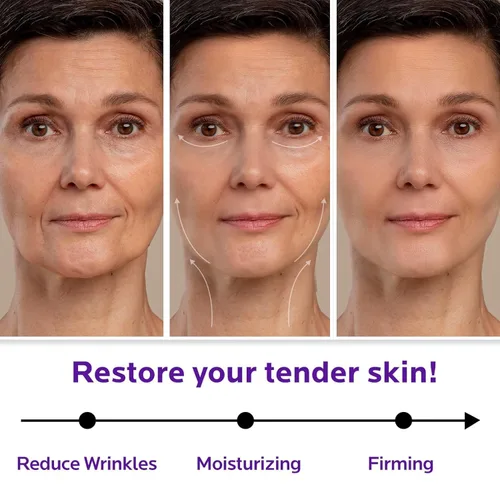Vista 2 de ZealSea Crema de retinol para rostro con colágeno, hidratante facial antienvejecimiento para mujeres para tensar y levantar la piel, crema de noche